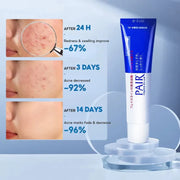 Crème Anti-Boutons Pair Acne W - Lion